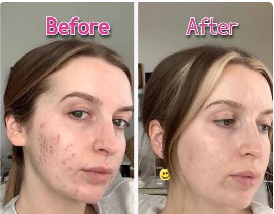 7-in-1 LED Face & Neck Wrinkle Massager with Free Gift